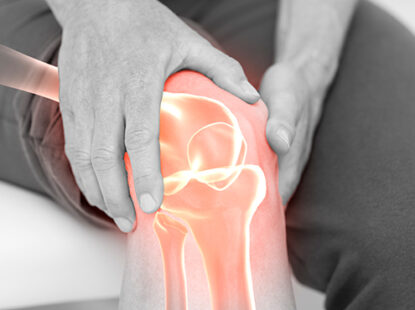 hardverska fizioterapija u liječenju artroze revoluciju u liječenju osteoartritisa