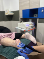 Fizikalna terpaija Tecar Fizio aktiva Krusevac